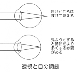 遠視と目の調節