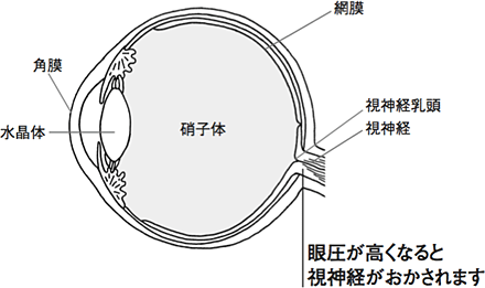 眼圧が高くなると視神経がおかされます