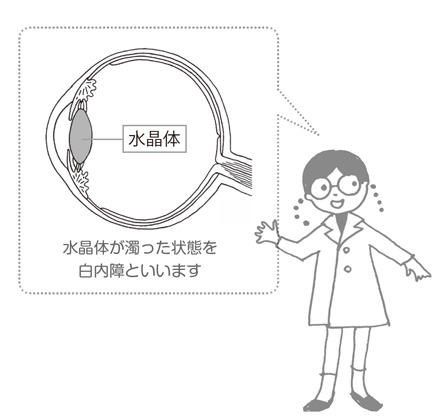 水晶体が濁った状態を
白内障といいます