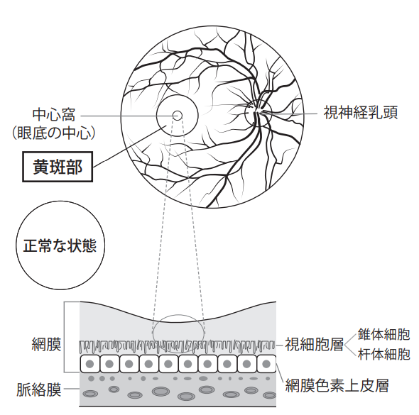 黄斑